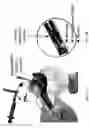 Fig. 02 - Methods, devices and formulations for targeted endobronchial therapy