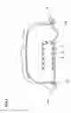 Fig. 08 - Runflat tire system and support ring therefor