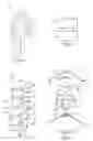 Fig. 02 - Constrained artificial implant for orthopaedic applications