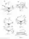 Fig. 06 - Constrained artificial implant for orthopaedic applications