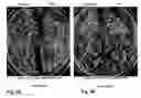 Fig. 15 - Repressor-mediated tissue-specific gene expression in plants