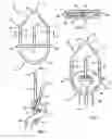 Fig. 02 - Rope clamp