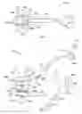 Fig. 02 - Gamma camera
