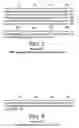 Fig. 08 - Tissue transglutaminase