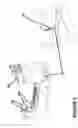 Fig. 15 - Connector lever lock