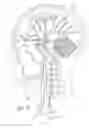 Fig. 03 - Indwelling heat exchange catheter and method of using same