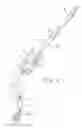 Fig. 04 - Indwelling heat exchange catheter and method of using same