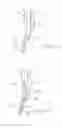 Fig. 09 - Indwelling heat exchange catheter and method of using same