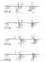 Fig. 07 - Undercutter for a shaving apparatus