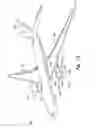 Fig. 02 - Methods and systems for removing material from aircraft flight surfaces