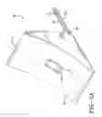 Fig. 04 - Tire-detecting wheel chock apparatus