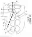Fig. 02 - Screw device for orthodontic treatment