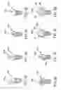 Fig. 04 - Screw device for orthodontic treatment