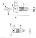 Fig. 06 - Screw device for orthodontic treatment