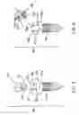 Fig. 07 - Screw device for orthodontic treatment