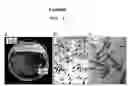 Fig. 02 - Method of overproduction of polyhydroxybutyrate