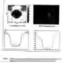 Fig. 02 - Tissue mimicking elastography phantoms