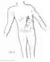 Fig. 02 - Skin seal with inflatable membrane