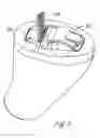 Fig. 13 - Method and apparatus for modular hearing aid