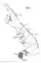 Fig. 02 - Splint or support with quick location technique