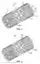 Fig. 02 - Expandable medical device with openings for delivery of multiple beneficial agents