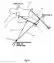 Fig. 03 - Intervertebral disc replacement prothesis