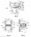 Fig. 09 - Intervertebral disc replacement prothesis