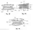 Fig. 12 - Intervertebral disc replacement prothesis