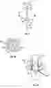 Fig. 04 - Endotracheal tube system and method of use