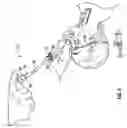 Fig. 07 - Endotracheal tube system and method of use