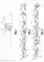 Fig. 02 - Watchband