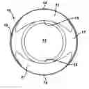 Fig. 01 - Rotationally stabilized contact lenses