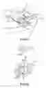 Fig. 06 - Dental evacuation mirror