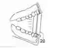 Fig. 01 - Ring-shaped illuminated mouth prop
