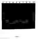 Fig. 02 - Multiplex RT-PCR/PCR for simultaneous detection of bovine coronavirus, bovine rotavirus, Cryptosporidium parvum, and Escherichia coli