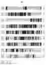 Fig. 03 - yapsin deficient mutant strain and process for the preparation of recombinant proteins using the same