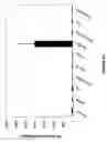 Fig. 09 - Diagnosing predisposition to fat deposition and associated conditions
