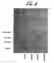 Fig. 05 - Device for sequential protein transfer from a gel