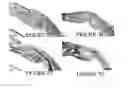 Fig. 12 - Compositions and methods for inducing and regulating bone formation