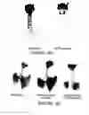 Fig. 27 - Compositions and methods for inducing and regulating bone formation