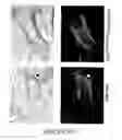Fig. 29 - Compositions and methods for inducing and regulating bone formation