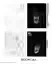 Fig. 30 - Compositions and methods for inducing and regulating bone formation