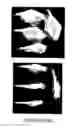 Fig. 32 - Compositions and methods for inducing and regulating bone formation