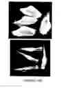 Fig. 33 - Compositions and methods for inducing and regulating bone formation
