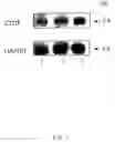 Fig. 02 - Identification of genes having a role in the presentation of diabetic nephropathy