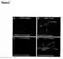 Fig. 04 - Methods of inducing differentiation of stem cells into a specific cell lineage