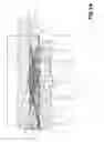 Fig. 04 - Grinding worm, profiling gear and process for the profiling of the grinding worm