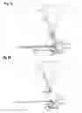 Fig. 11 - Shifting device for the mechanical coupling-free transmission of shift commands to the automatic transmission of a motor vehicle
