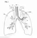 Fig. 02 - Tissue volume reduction