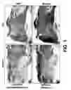 Fig. 02 - Methods and compositions for the promotion of a hair growth utilizing actin binding peptides